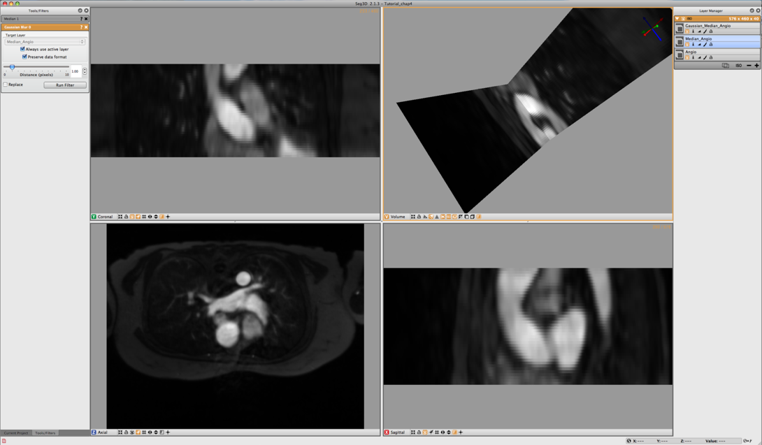 FilteredAngioData