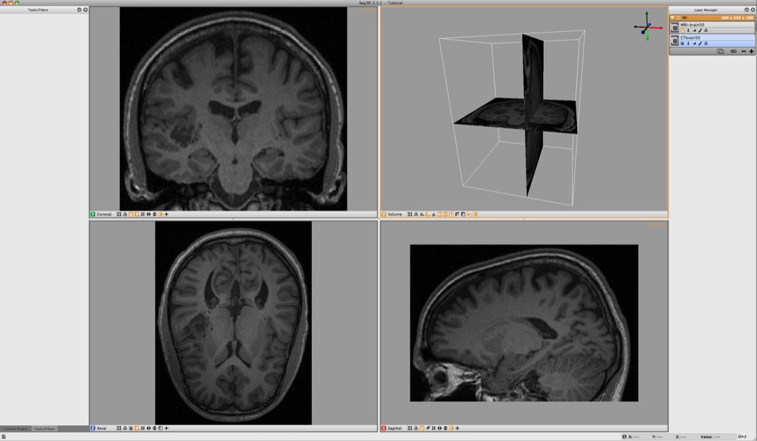 LoadingBrainDataSet