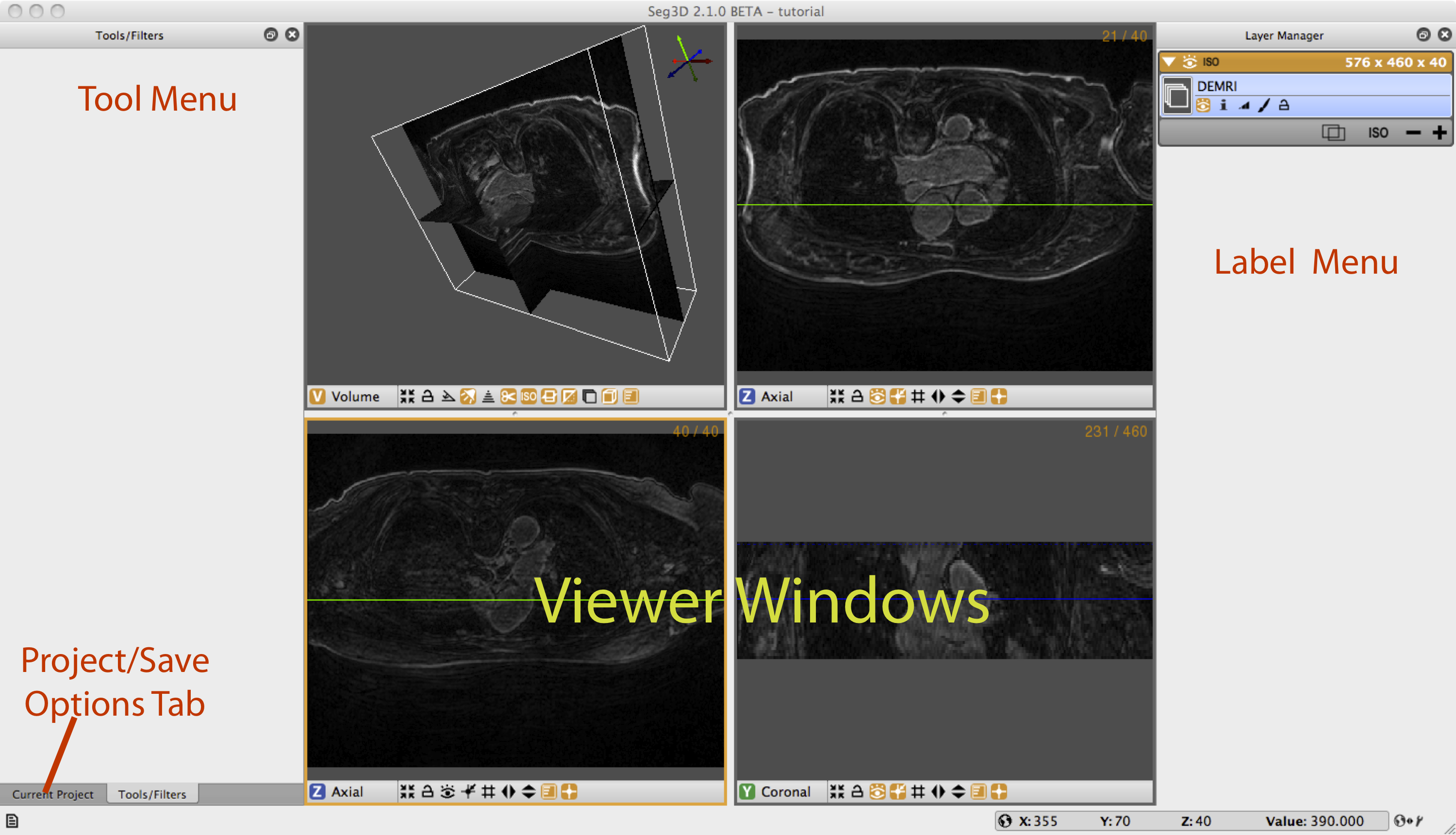 MainSeg3DWindow