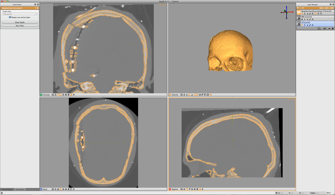 SkullSegmentation