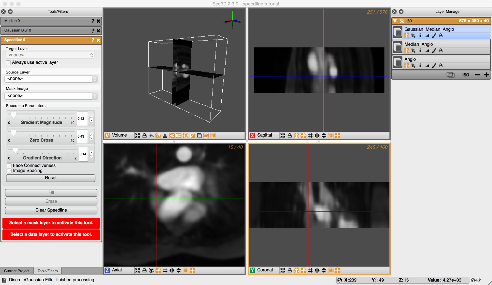 SpeedImage
